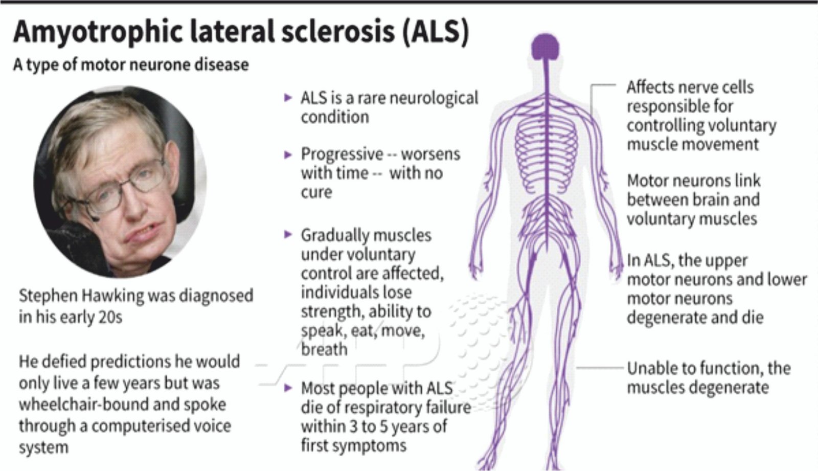 AMYOTROPHIC LATERAL SCLEROSIS ALS Current Affairs Editorial Notes