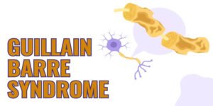 GUILLAIN BARRE SYNDROME (GBS)