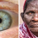 WHO DECLARES INDIA FREE OF TRACHOMA