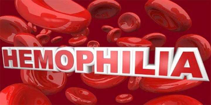 HEMOPHILIA